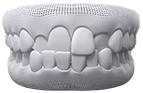 https://calidentcancun.com/wp-content/uploads/2021/11/perfect-smile-orthodontics-crossbite-1.png