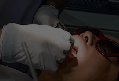 3 on 6 dental implants - Calident Cancun dentist prices