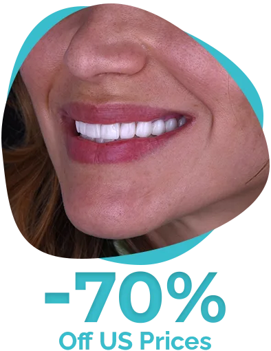 Low Cost Cancun veneers