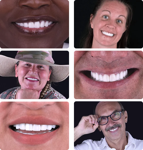 Calident patients collage - Cancun dental care photos