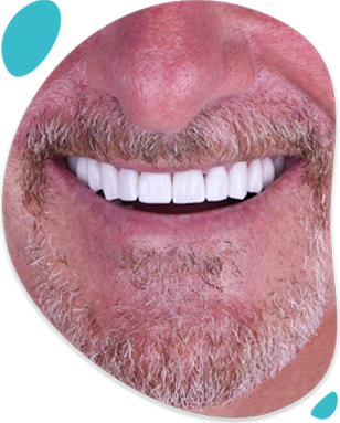 pre-and-post-care-for-dental-implants-surgery pre and post care for dental implants surgery